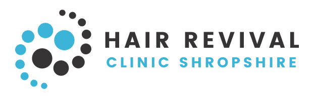 Hair Revival Clinic SMP Shrewsbury